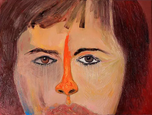 Agnieszka Kurlenda - ALERGIA