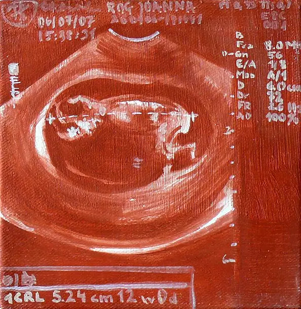 Joanna Róg Ociepka -  Dziecko II 