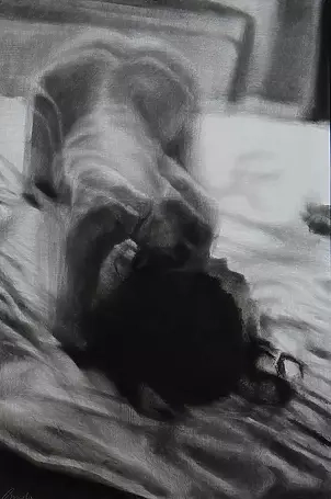 Kamila Ossowska - Anesthesia