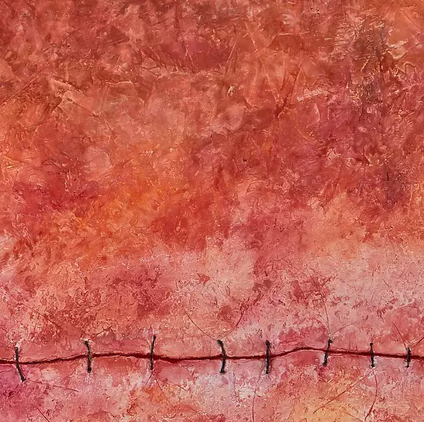 Arkadiusz Świderski - Scar