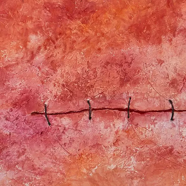 Arkadiusz Świderski - Scar