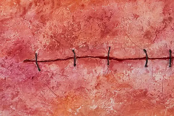 Arkadiusz Świderski - Scar