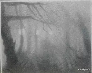 Zbigniew Bień - Park in the fog