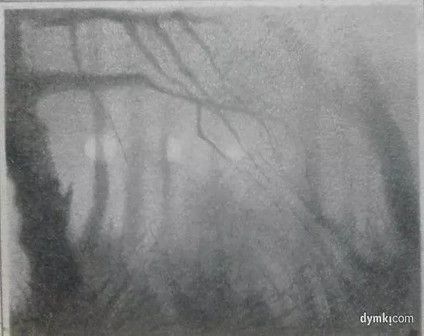 Zbigniew Bień - Park we mgle