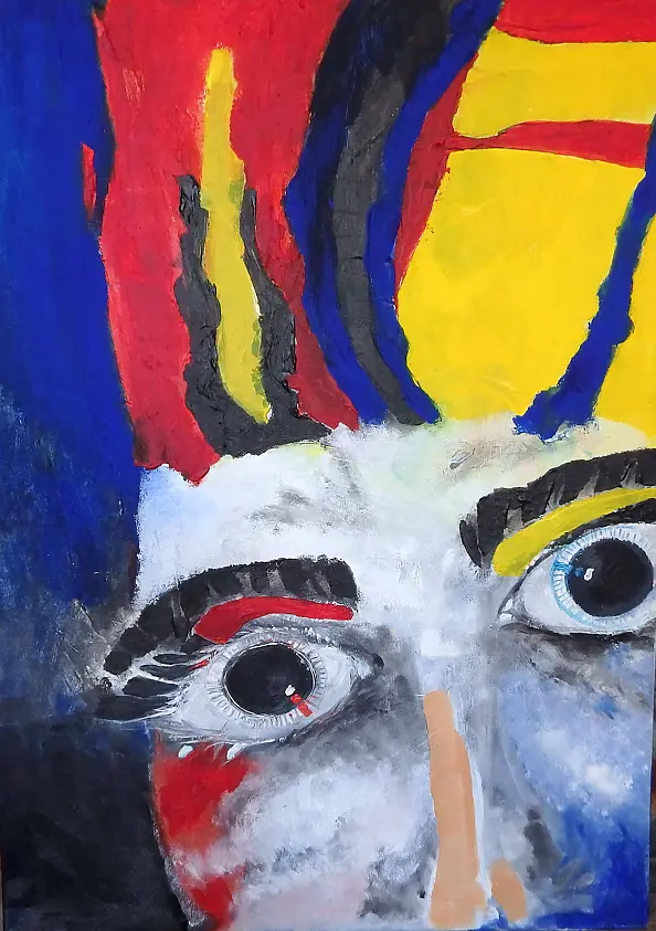 Sylwia Błażej-Sosnowska - Wytrzeszcz