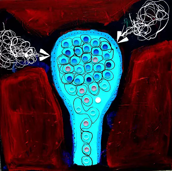 Paweł Zakrzewski - my hip (healing painting)